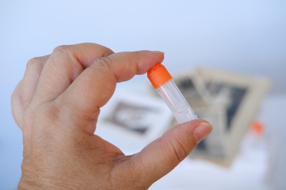 Synthetic gels mucuslike fluids Rheomuco